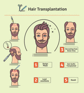 hair transplant process 3